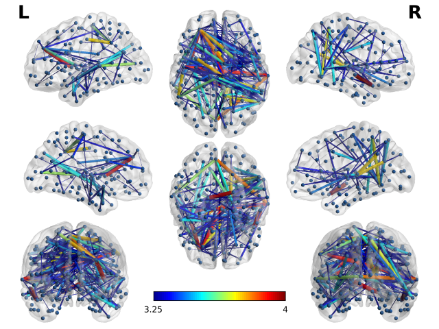 Brain white matter connections
